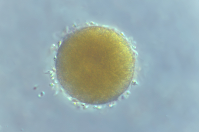 Fécondation d'une oosphère de Fucus vésiculeux par des anthérozoïdes x110